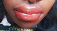 Donkere lippen lichter maken met PMU. De eerste dag zwollen de lippen op, maar dat geneest snel.
